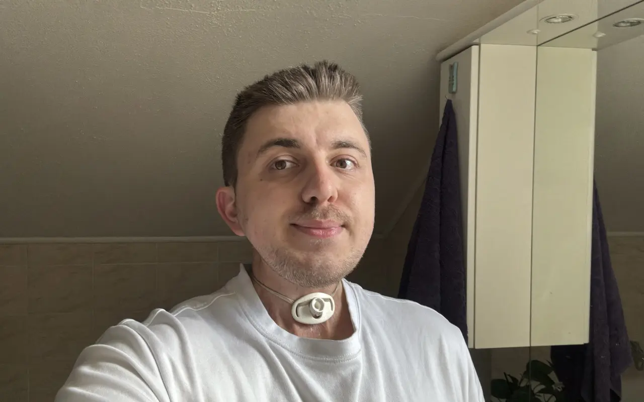 Pomôžte Jakubovi v ťažkej životnej situácii