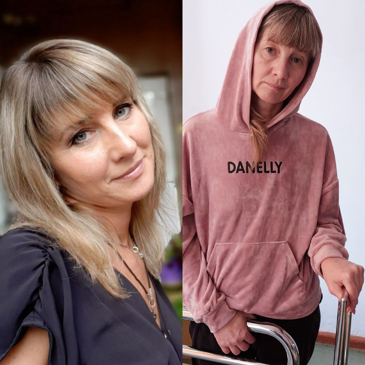 Pomôžeme dcére získať potrebnú sumu na operáciu pre jej mamu na Ukrajine