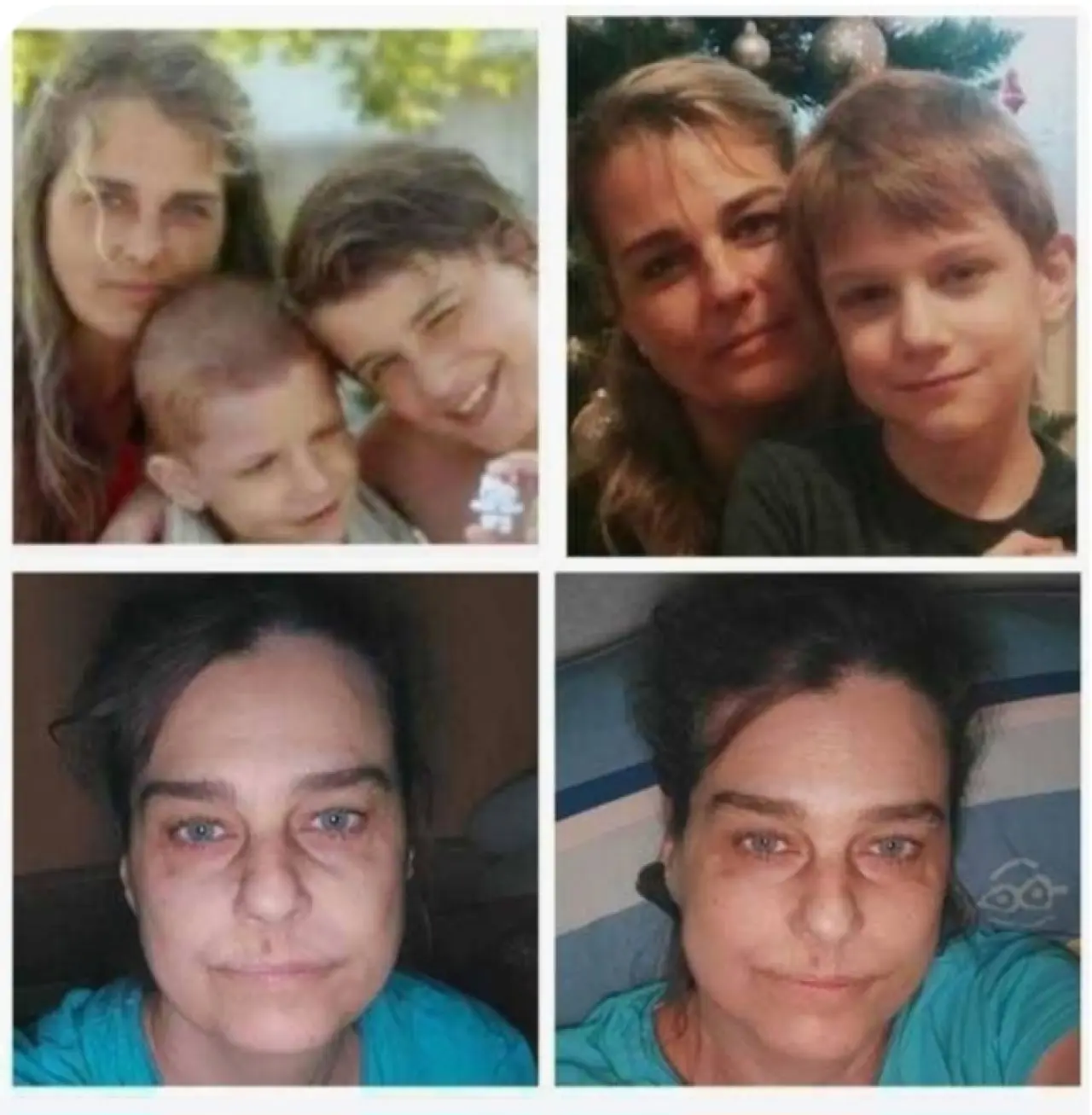 Pomohli ste Slávke na liečbu a návrat k životu
