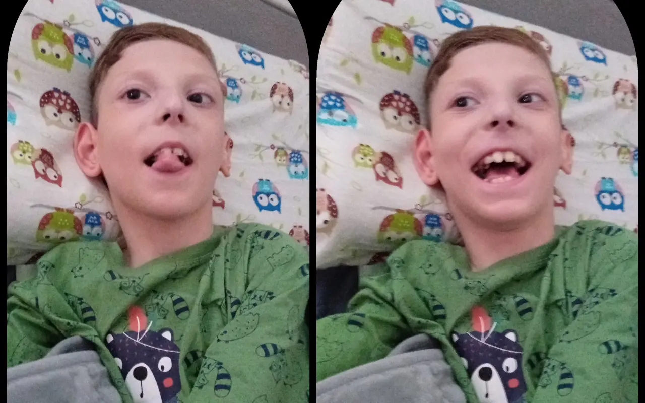 Pomôžme Samkovi získať špeciálne auto na bezpečné cesty za liečbou
