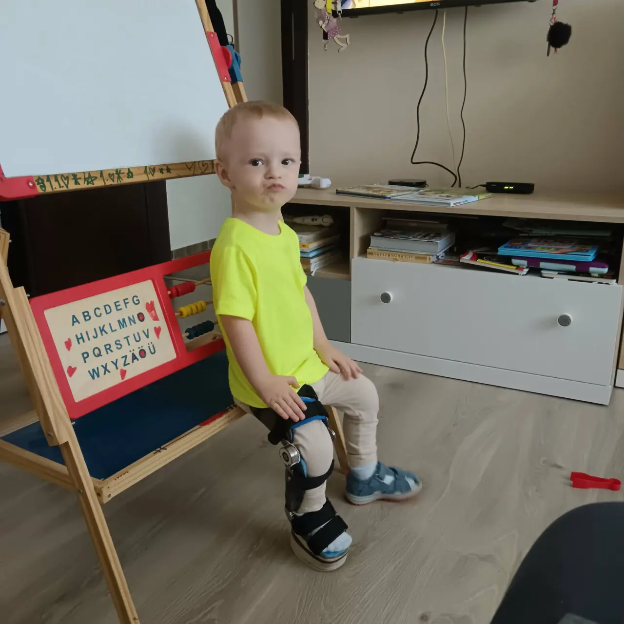Doprajme Jakubkovi šancu na lepší pohyb a vyrovnanie nožičky