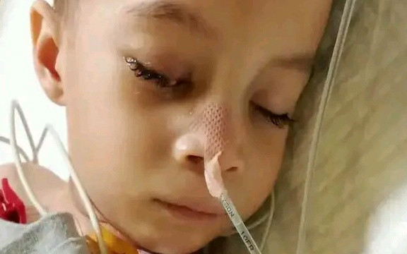 Pomôžme malému Kevinovi, ktorý od narodenia bojuje s vážnym ochorením