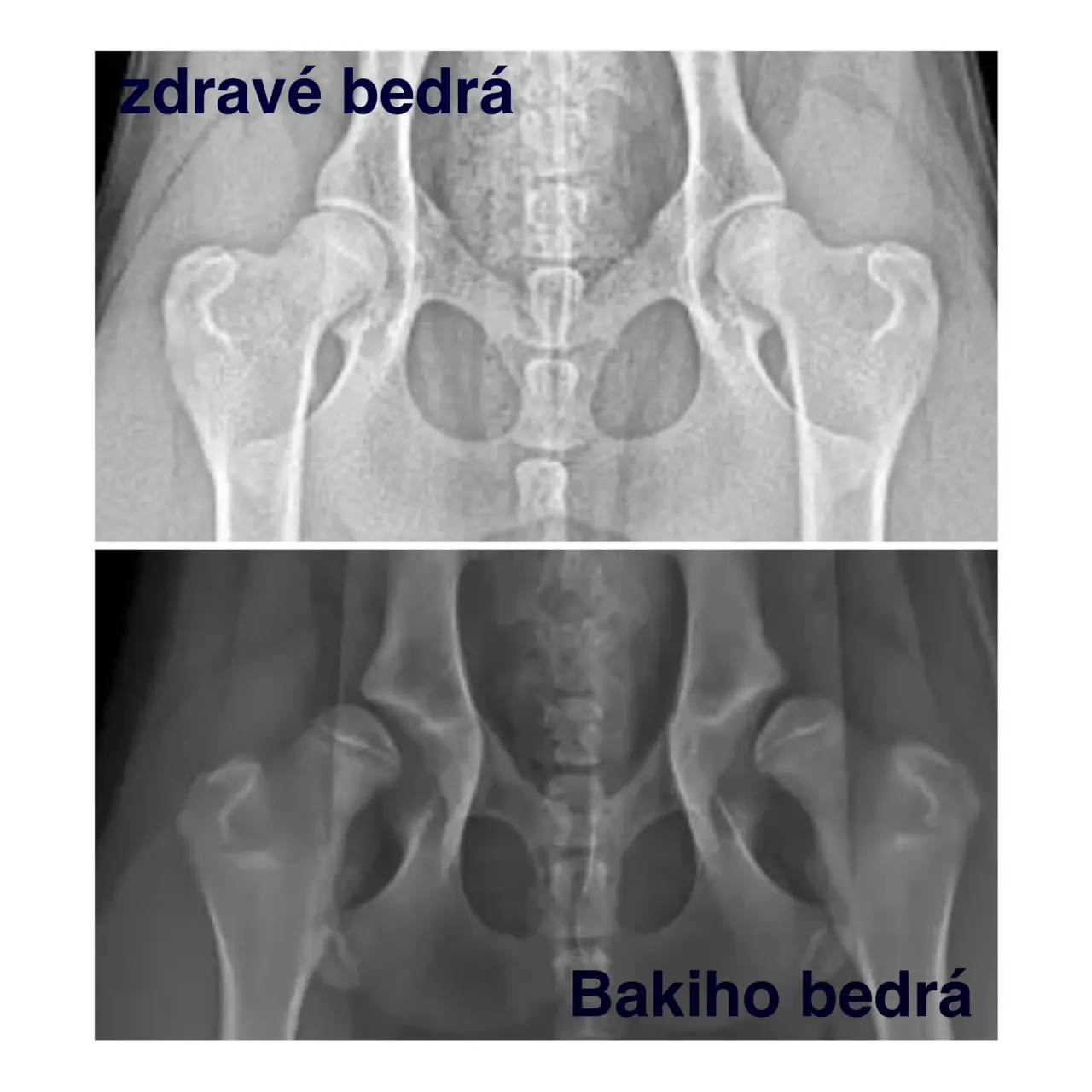 Pomohli ste Bakimu chodiť bez bolesti