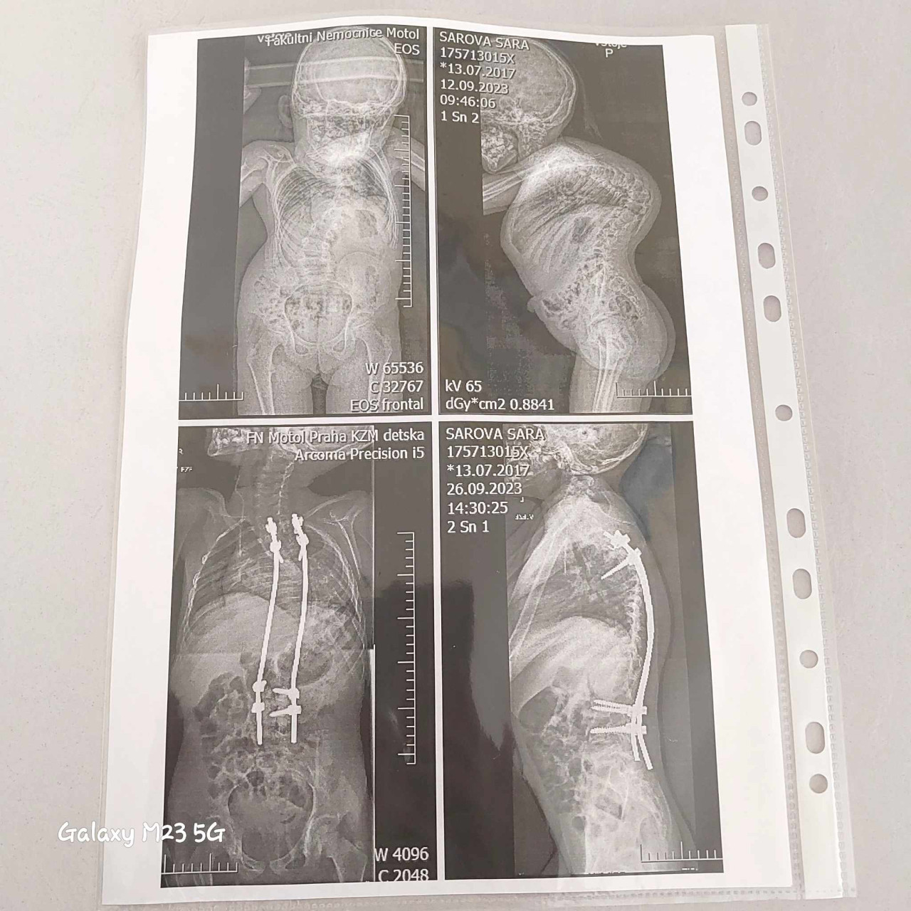Pomôžme Sárkinej rodine uhradiť náklady spojené s liečbou