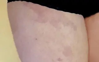 Liečba, ktorá pomôže aj na duši