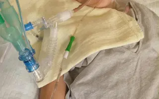 Pomôžme Tomáškovi s liečbou po vážnej autonehode