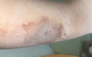 Darujme Laure lístok za nádejou - umožnime jej cestu za vyšetreniami do Španielska