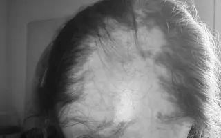 Darujme Márii parochňu a pomôžme jej posunúť sa do novej životnej kapitoly