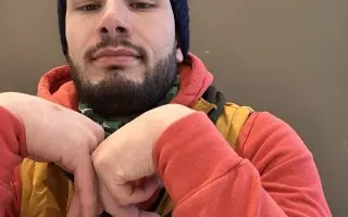 Nehoda na motorke mi vzala úsmev. Pomôžte mi získať ho späť.