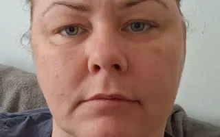 Pomôžme Lýdii udržať si domov a zvládnuť liečbu