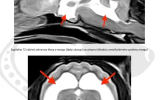 Zojka potrebuje MRI. Pomôžme jej ho zabezpečiť.