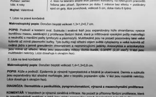 Pomôžte nám zachrániť Mexika