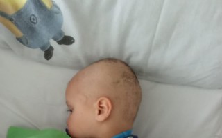 Pomôžme Dominikovi a jeho rodine prekonať náročné obdobie
