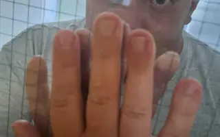 Pomôžme invalidnému dôchodcovi Jankovi splatiť nevýhodný úver