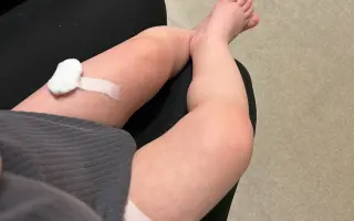 Pomôžme Samkovi dýchať bez strachu