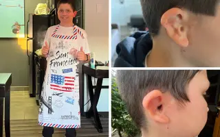 Iba jedno ucho od dokonalosti – podporte Samkovu operáciu zvukovodu v USA