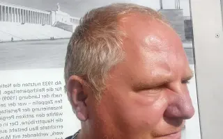 Pomôžme Mariánovi stabilizovať jeho životnú a zdravotnú situáciu