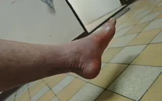 Pomôžme otcovi po úraze postarať sa o svoju rodinu