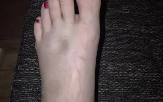 Pomôžte mi zotaviť sa, prežiť a vrátiť úsmev do života
