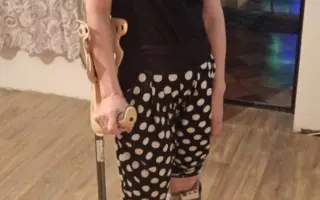 Pomôžme Katke rehabilitovať a vrátiť jej úsmev na tvári