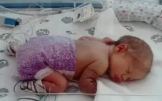 Malá Emmka potrebuje našu pomoc, aby mohla rehabilitovať