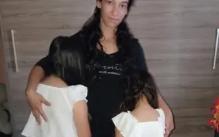 Pomôžme Márii vrátiť sa k životu bez bolesti a získať nový chrup