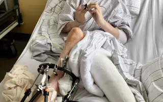 Pomôžme Kikovi pokračovať v náročnej liečbe zdeformovaných nožičiek