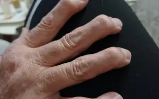 Pomôžme splatiť Slávke úver na bývanie