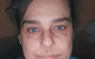 Pomôžme Slávke: Keď telo vypne, každý deň je boj.