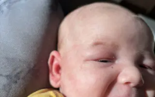 Pomôžme Sebkovi vrátiť jeho zdravú pokožku