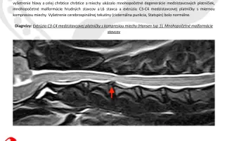 Pomôžme Teovi získať šancu na život bez bolesti