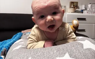 Pomôžme Sebkovi vrátiť jeho zdravú pokožku