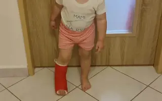 Trojročná Vikinka namiesto hier trávi detstvo v sadre a nemocniciach