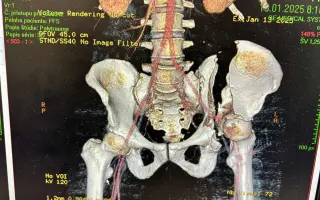 Pomôžme Petrovi s prežitím obdobia medzi PN a invalidným