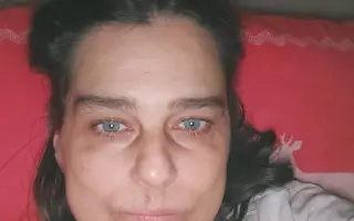 Pomôžme Slávke, ktorá bojuje s chronickým únavovým syndrómom