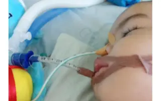 Leo má iba jeden rok. Pomôžte mu prebudiť sa z bdelej kómy.