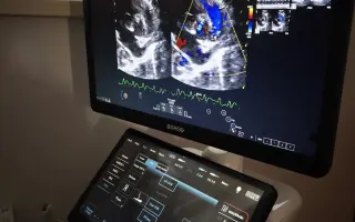 Darujte Srdiečku novú šancu na život