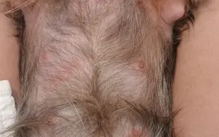 Pomôžme Leuške žiť bez bolesti a svrbenia