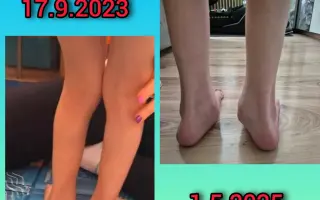 Podporte malého bojovníka Kubka, ktorý potrebuje veľkú pomoc