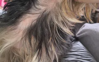 Pomôžme Leuške žiť bez bolesti a svrbenia