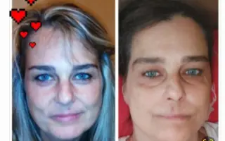 Pomôžme Slávke: Keď telo vypne, každý deň je boj.