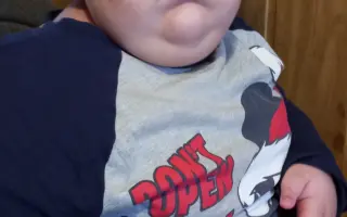 Pomôžte Naomi Elizabeth žiť o kúsok lepší život