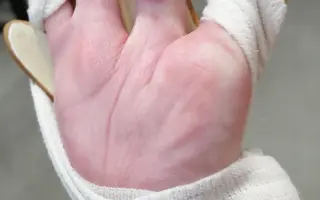 Spoločne pomôžme Tomáškovi zabezpečiť rehabilitácie