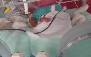 Pomôžme Michalovi s rehabilitáciami a liečbou