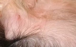 Pomôžme Leuške žiť bez bolesti a svrbenia