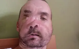 Pomôžme Marekovi a jeho mame zvládať život po ťažkej autonehode