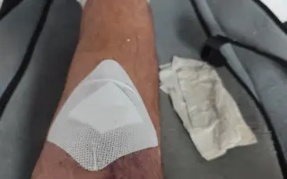 Krok za krokom späť do života. Pomôžme Marekovi rehabilitovať