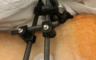 Pomôžme Petrovi s prežitím obdobia medzi PN a invalidným