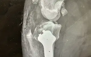 Pomôžte Lole chodiť bez bolesti – súrne potrebuje operáciu