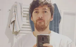 Pomôžme Kristiánovi s rekonštrukciou chrupu